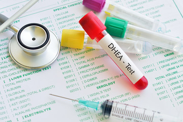 Blood sample for DHEA hormone test
