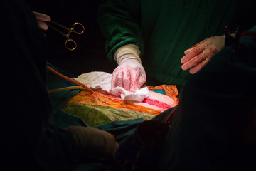 closure sternum bone with metal wires
