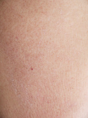 Fototapeta premium human skin texture