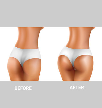 before and after buttocks exercise
