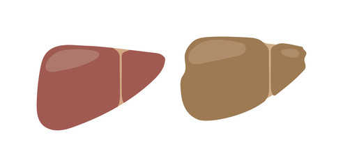 Realistic human liver vector medical illustration. Medicine anatomy human liver, organ human, health and biology. Liver patients with hepatitis repercussion alcoholism human liver.