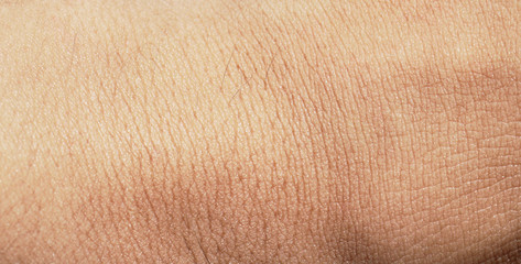human skin texture