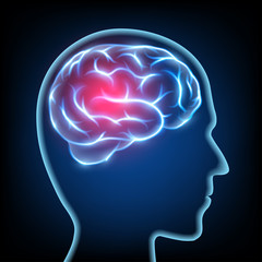 Obraz premium Silhouette of a human head. Migraine disease. Brain nervous syst