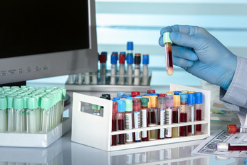 scientist with a tube of blood in front of a computer screen / hand holding tube with blood sample analysis in the laboratory