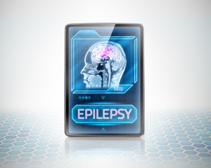 Modern medical tablet displaying epileptic brain