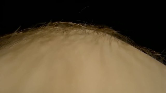 Insect crawling through the hair on the human leg. Macro