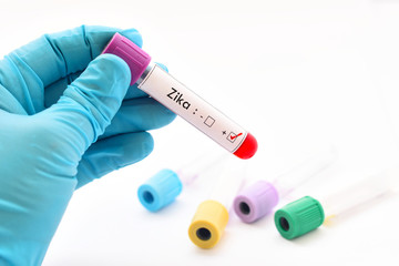 Naklejka premium Zika virus positive