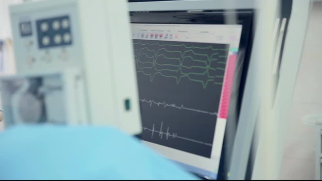 Real Cardiogram. Working cardiograph in a cardiology hospital. 1080p.