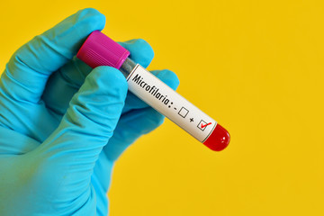 Obraz premium Blood sample positive with Microfilaria parasite (roundworms)