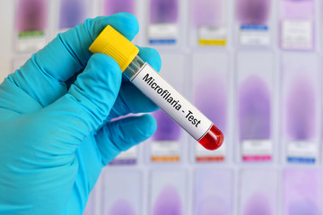 Blood sample for Microfilaria parasite (roundworms) test
