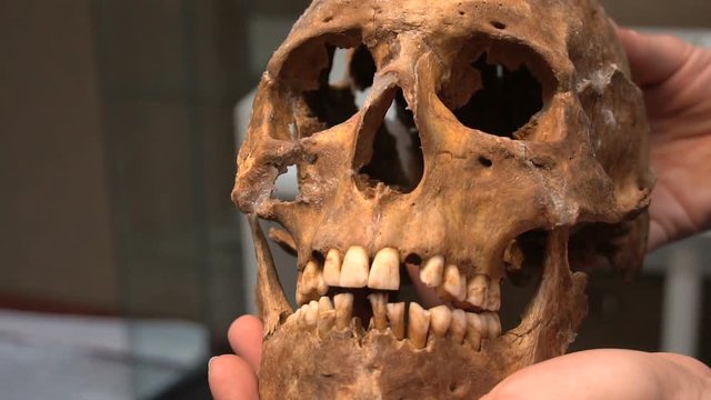 Anthropology. Skull Men Nomadic Sarmatian Age Of 3000 Years In The Hands Of The Scientist In The Museum