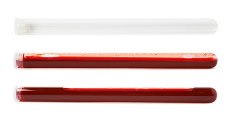 Glass test-tube filled with blood