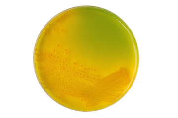 Vibrio cholerae bacterial colonies on TCBS selective medium agar