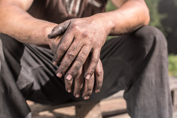 Worker Hands. Charcoal-burners worker man with dirty hands. - 116054322