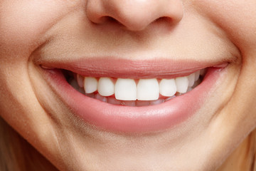 Sincere wide smile girls closeup. White teeth