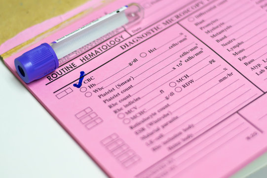 Test tube on request form in laboratory