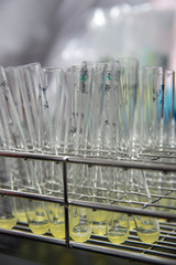 Test tubes filled with human plasma