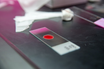 Blood sample on microscope slide - 116272566
