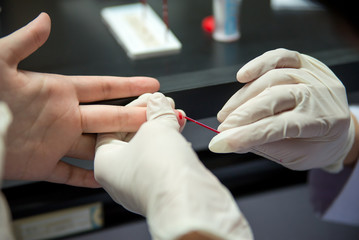 Capillary tube blood collection - 116272576