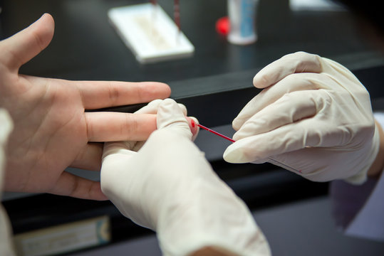 Capillary Tube Blood Collection