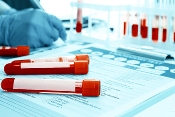 Blood samples and doctor hands on medical report