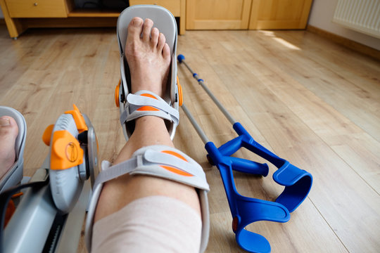 mann mit camoped und knie operation