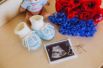 Obraz na płótnie Canvas The image of pregnancy. Ultrasound picture. Baby shoes.