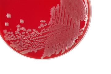 Salmonella enteritidis bacterial colonies on blood agar plate, m