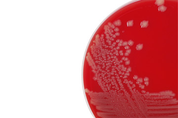 Salmonella enteritidis bacterial colonies on blood agar plate, m