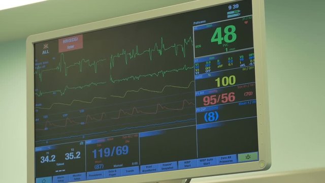 Heart monitor display in the operating theather.