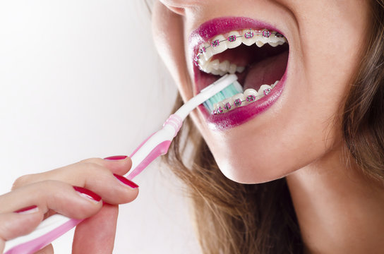 Closeup woman brushing teeth with braces