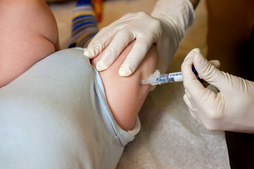 Needle In Infant Leg