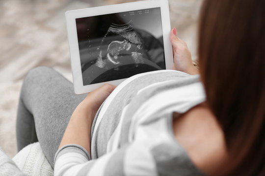Young pregnant woman looking on ultrasound photo in tablet