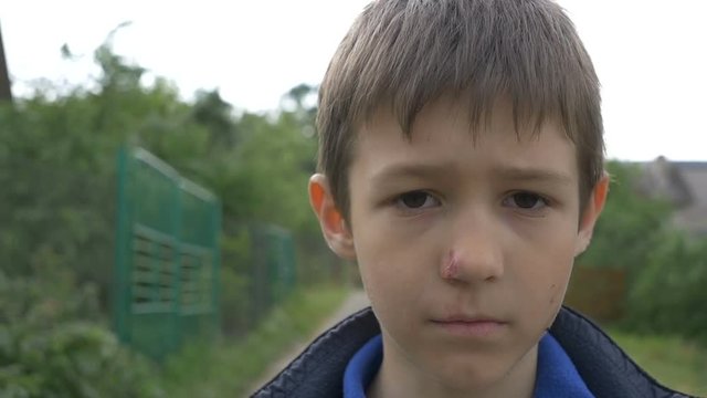 Angry Dirty Beaten Boy on the Street closeup, Plans on Revenge