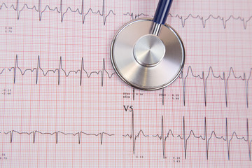 stethoscope on a cardiogram