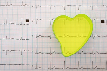 ecg paper and heart form
