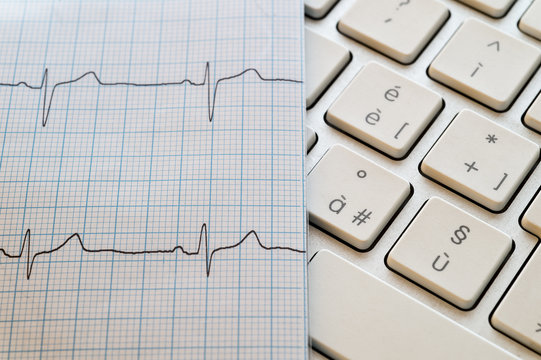 ecg paper and key board