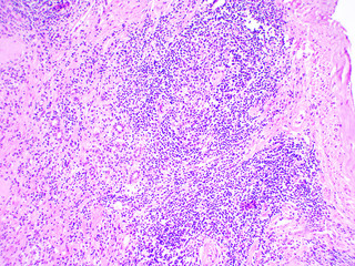 Microscopic image of kidney, zoom x100