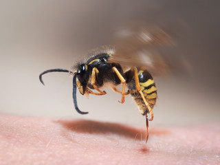 Wasp sting pulls out of human skin. macro - obrazy, fototapety, plakaty