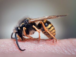 Wasp on a human hand. The sting of a wasp in the skin. Swelling, redness. macro