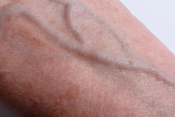 Fototapeta premium veins on the wrist of an older woman
