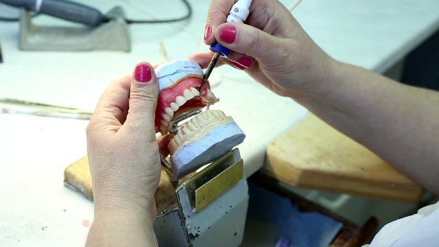 Manufacture Of Dentures in Dental Clinic