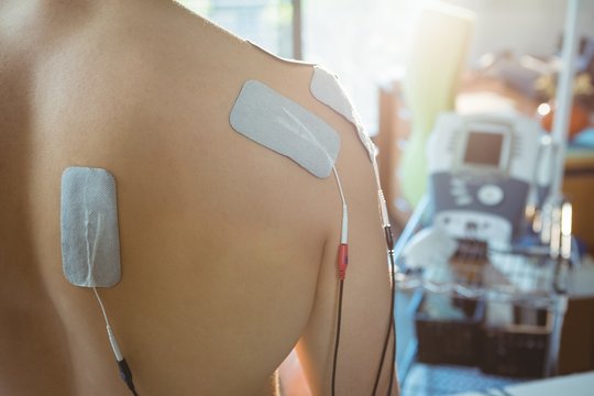 Male patient with electro stimulator electrodes on his back