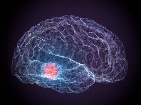 Cervello malattie degenerative Parkinson