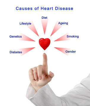 Causes of Heart Disease
