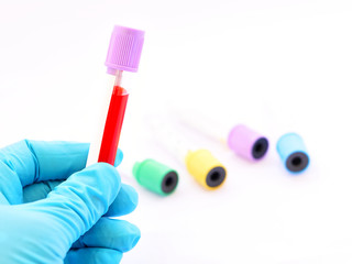 Blood sample for laboratory testing
