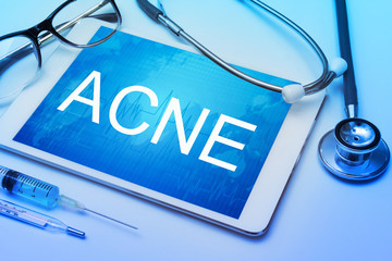 Acne word on tablet screen with medical equipment on background