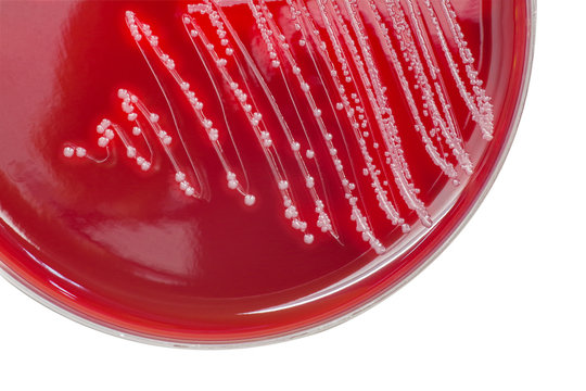 Streptococcus bacterial colonies with beta hemolytic on blood agar plate