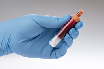 Blut, Blutprobe im test Röhrchen Blutuntersuchung