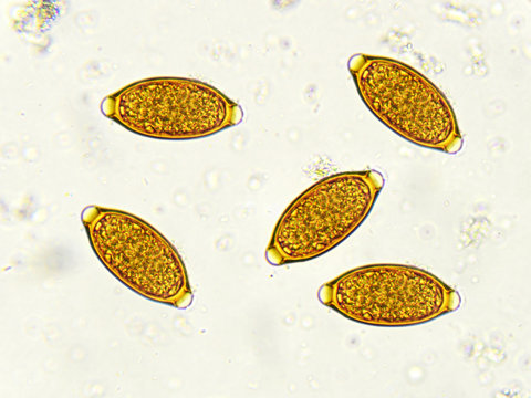 Eggs of Trichuris trichiura (whipworm) in stool Stock Photo | Adobe Stock